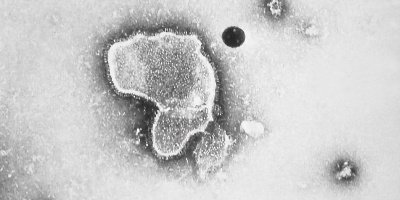 RSV (respirační syncytiální virus)