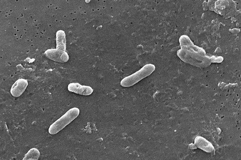 Bakterie rodu Bordetella, blízké příbuzné původce černého kašle, v elektronovém mikroskopu
