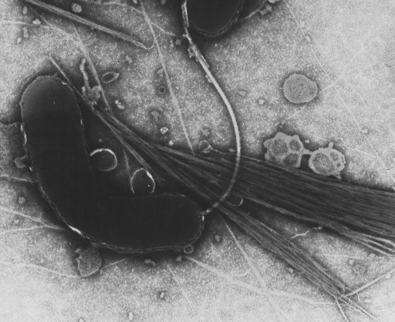 Bakterie Vibrio cholerae s bičíkem v elektronovém mikroskopu