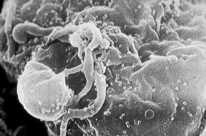 Virus HIV pučící z povrchu napadené bílé krvinky