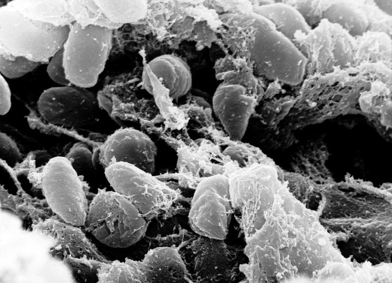 Bakterie Yersinia pestis, původce moru, v rastrovacím elektronovém mikroskopu