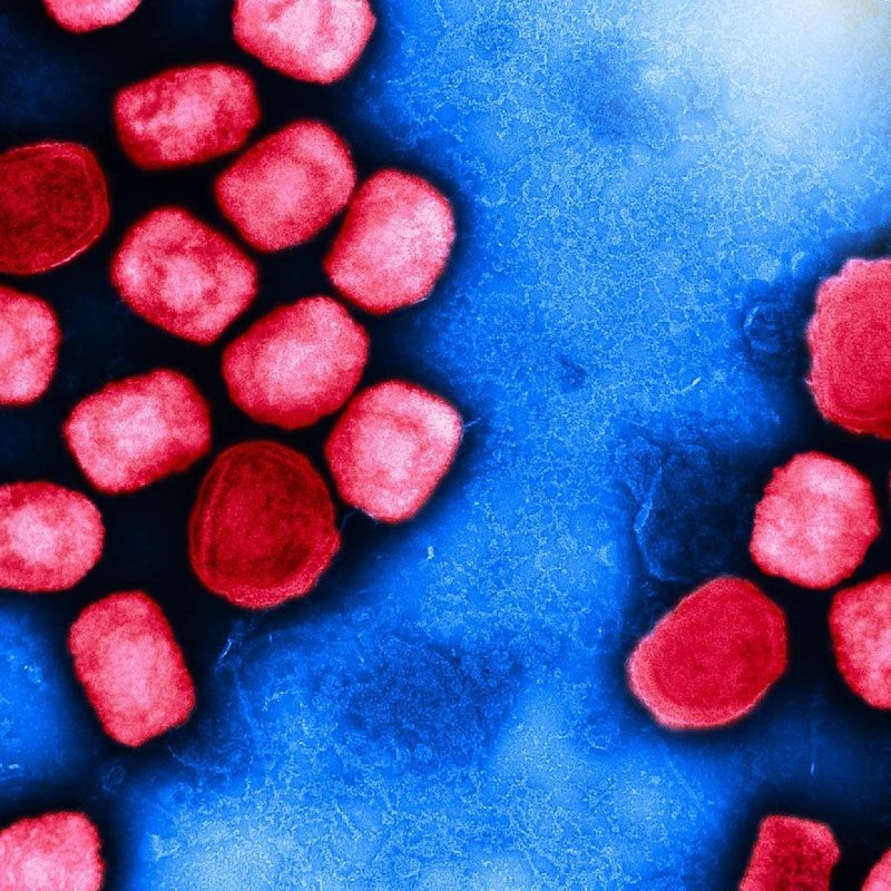 Částice viru mpox v elektronovém mikroskopu (barevně upraveno)