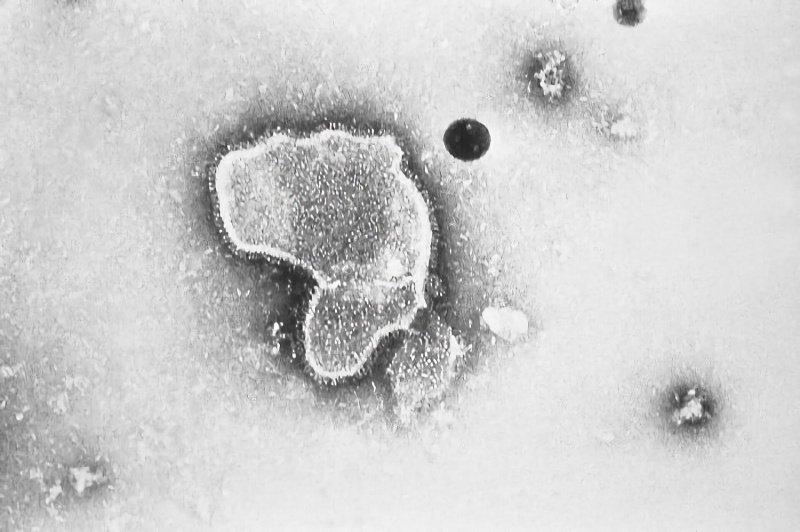Respirační syncytiální virus v elektronovém mikroskopu