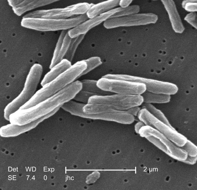 Bakterie Mycobacterium tuberculosis v rastrovacím elektronovém mikroskopu