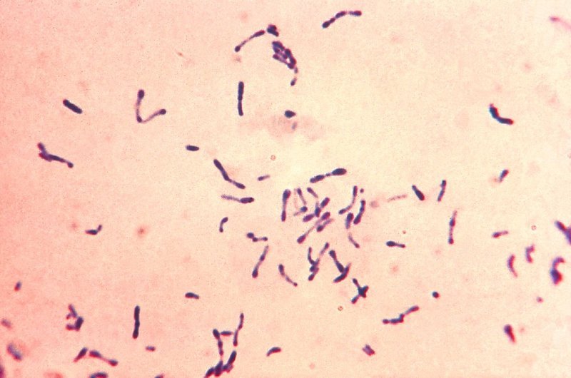 Bakterie Corynebacterium diphtheriae obarvené podle Grama
